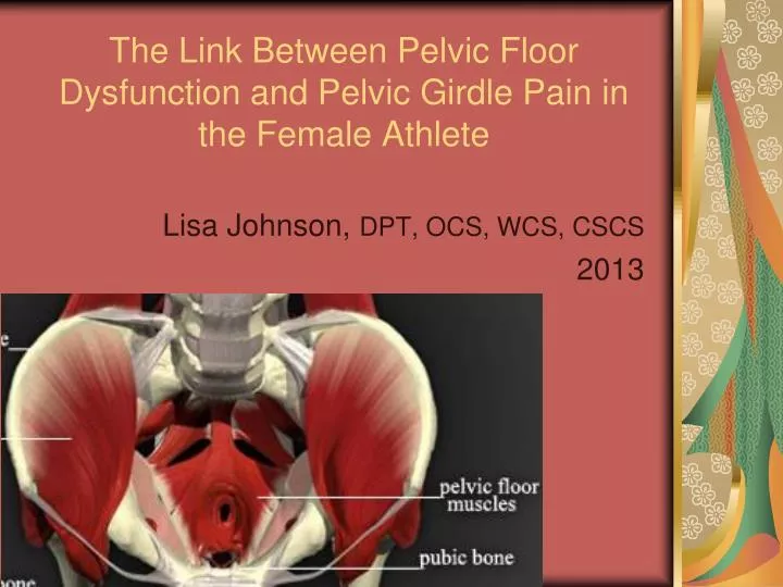 the link between pelvic floor dysfunction and pelvic girdle pain in the female athlete