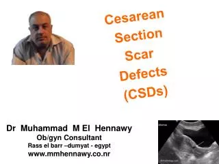 Cesarean Section Scar Defects (CSDs)