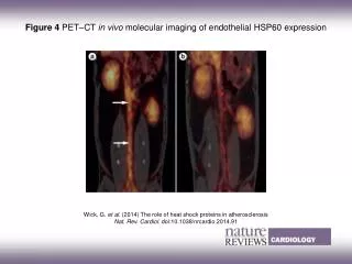 Wick, G. et al. (2014) The role of heat shock proteins in atherosclerosis