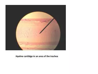 Hyaline cartildge in an area of the trachea