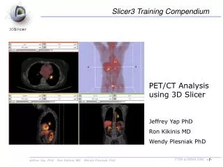 PET/CT Analysis using 3D Slicer
