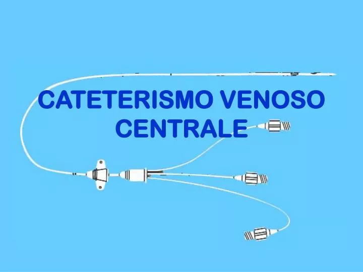 cateterismo venoso centrale