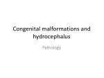 Congenital malformations and hydrocephalus - slide 1