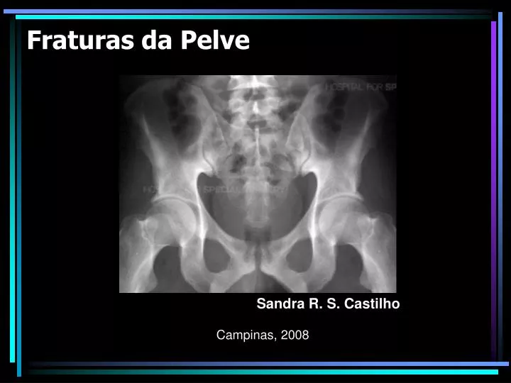 fraturas da pelve