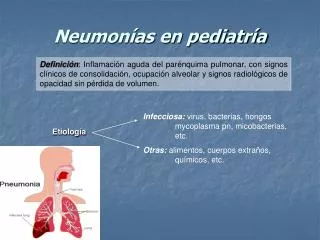 neumon as en pediatr a