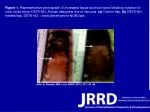 Improved Tissue Survival with Nitric Oxide Donor Injection in Flap Surgery - slide 1