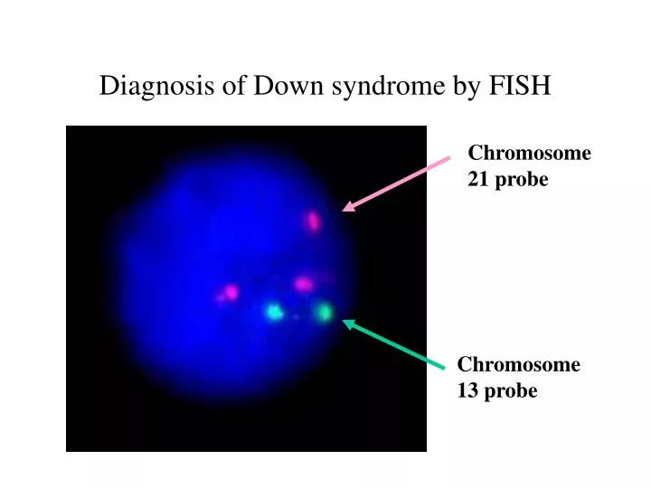 diagnosis of down syndrome by fish