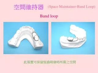 space maintainer band loop