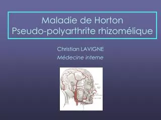 maladie de horton pseudo polyarthrite rhizom lique