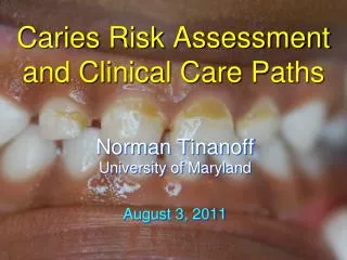 Caries Risk Assessment and Clinical Care Paths