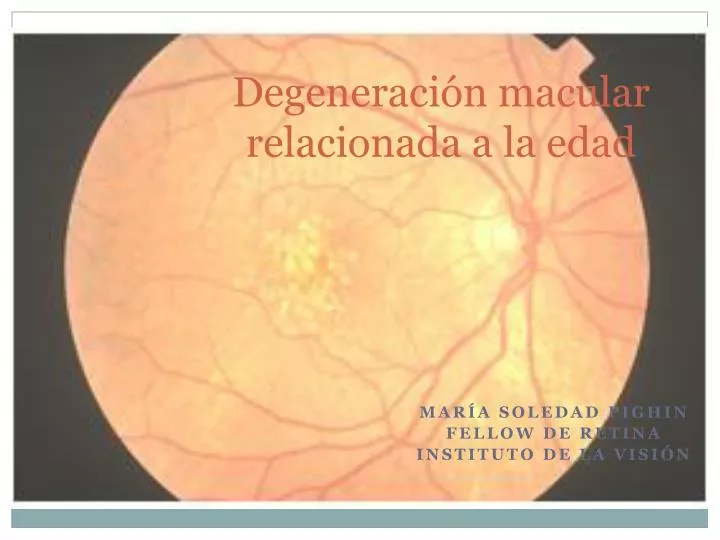 degeneraci n macular relacionada a la edad