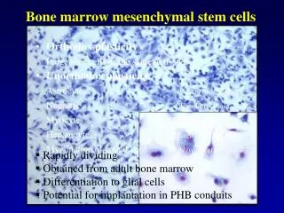 Bone marrow mesenchymal stem cells
