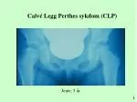 Calvé Legg Perthes sykdom (CLP) - slide 1