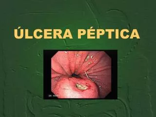 lcera p ptica