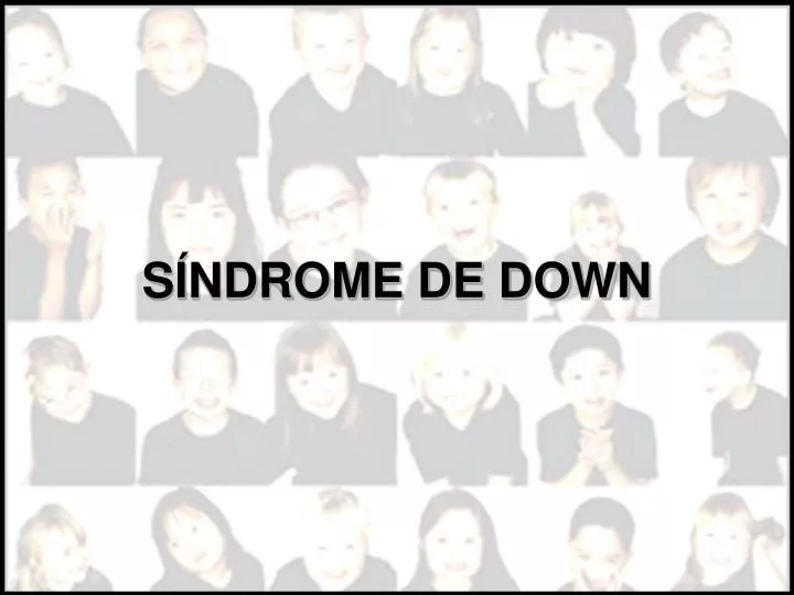 s ndrome de down