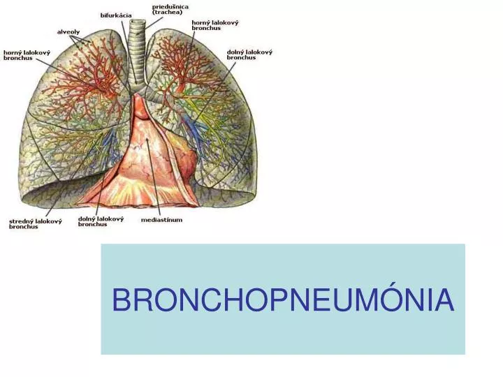 bronchopneum nia