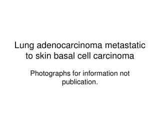 Lung adenocarcinoma metastatic to skin basal cell carcinoma