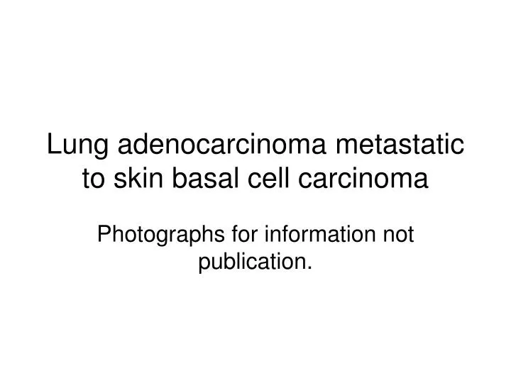 lung adenocarcinoma metastatic to skin basal cell carcinoma