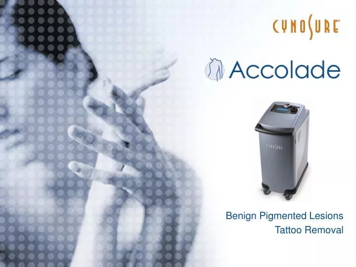 benign pigmented lesions tattoo removal
