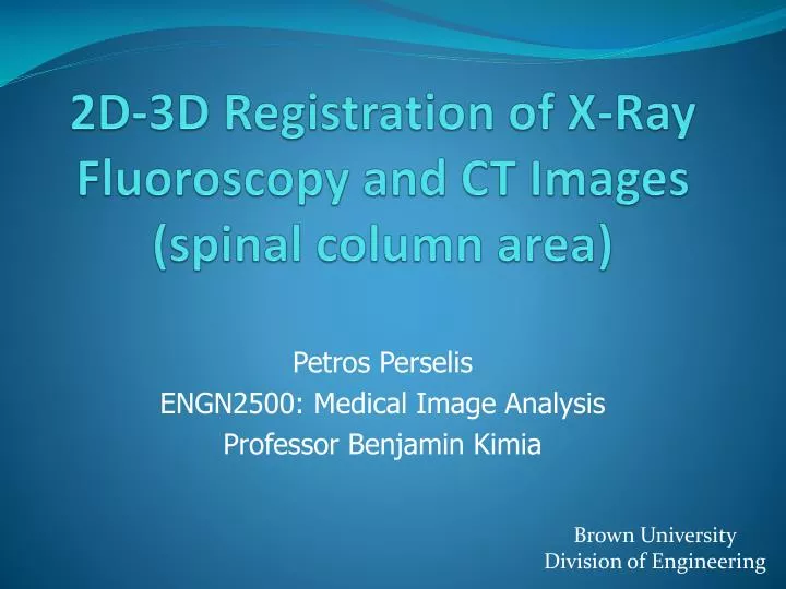 2d 3d registration of x ray fluoroscopy and ct images spinal column area