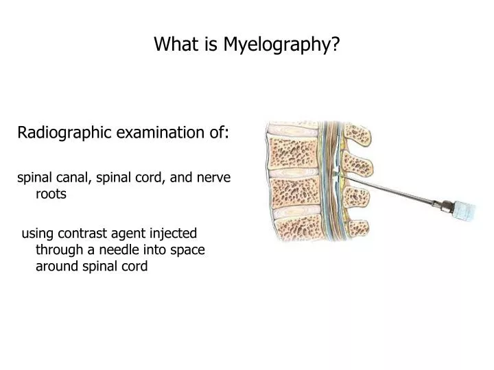 what is myelography