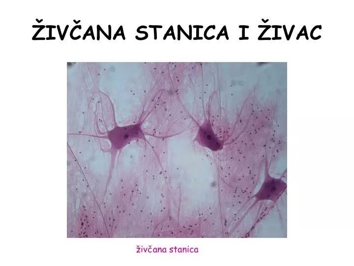 iv ana stanica i ivac