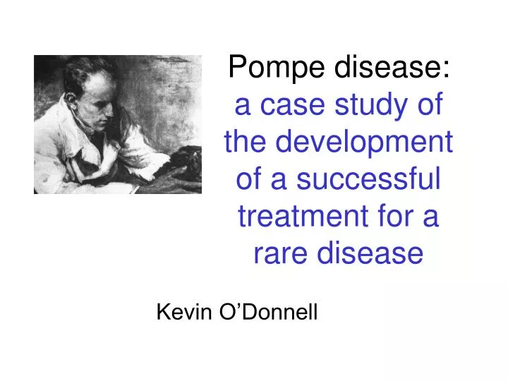 pompe disease a case study of the development of a successful treatment for a rare disease