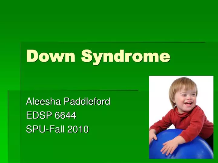 PPT - Down Syndrome PowerPoint Presentation, free download - ID:4059288