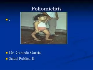 poliomielitis