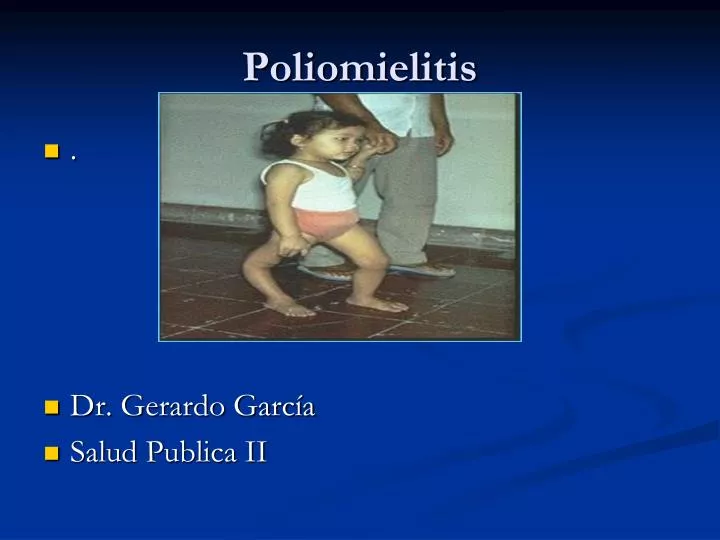 poliomielitis