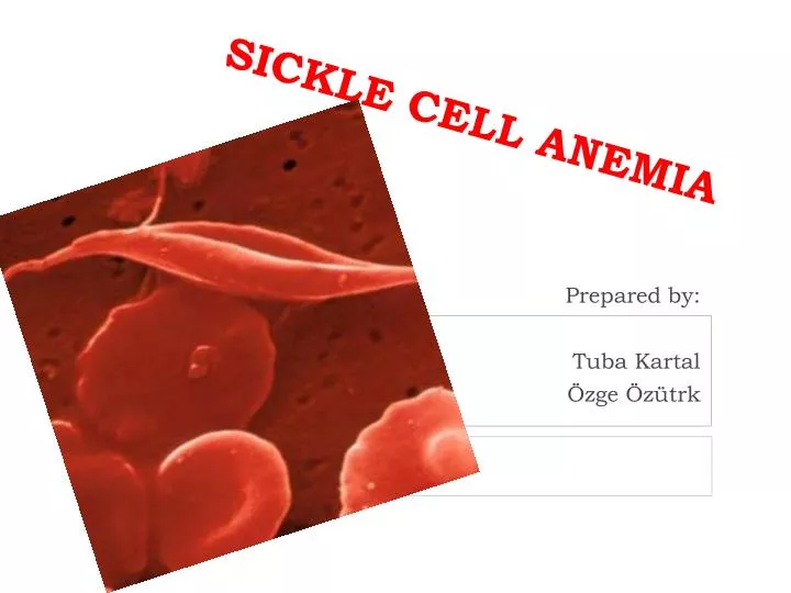 sickle cell anemia