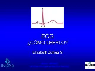ecg c mo leerlo