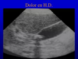 Dolor en H.D.