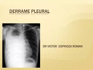 dr victor espinoza roman