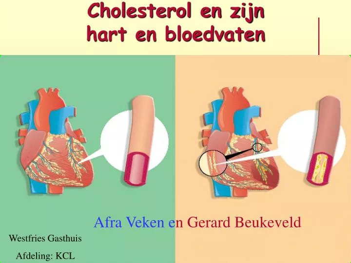 cholesterol en zijn hart en bloedvaten