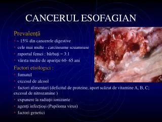 cancerul esofagian
