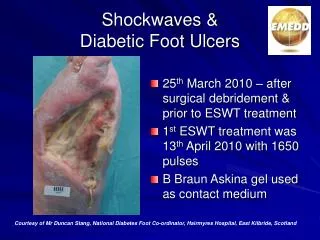 Shockwaves &amp; Diabetic Foot Ulcers