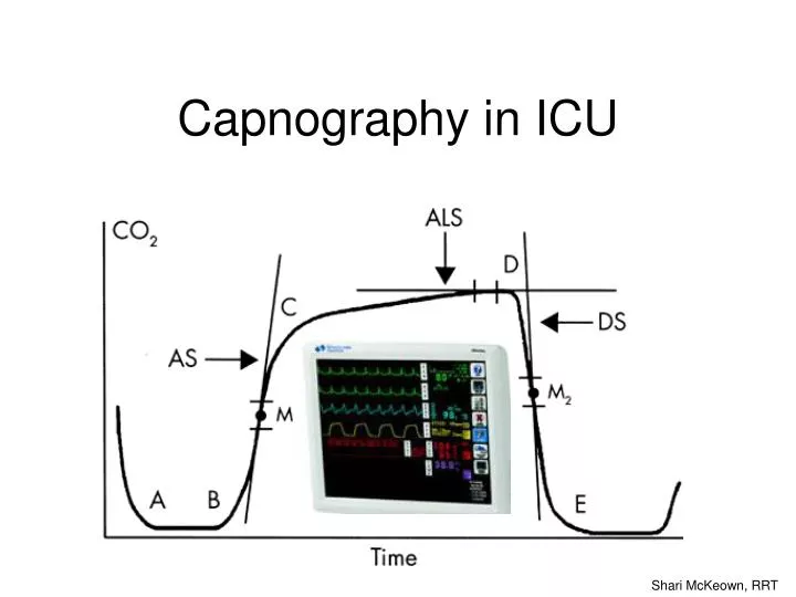 capnography in icu
