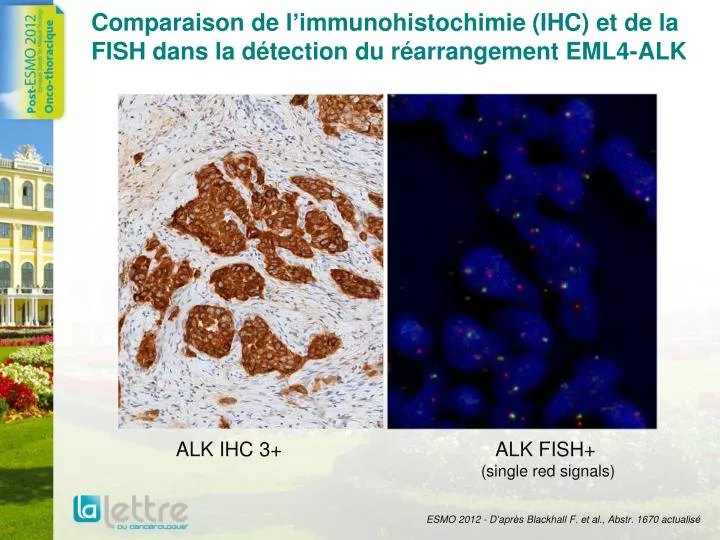 comparaison de l immunohistochimie ihc et de la fish dans la d tection du r arrangement eml4 alk