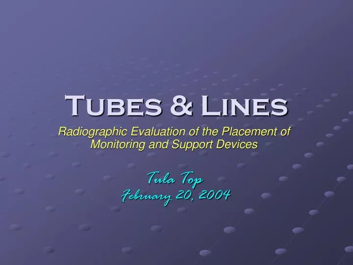 tubes lines