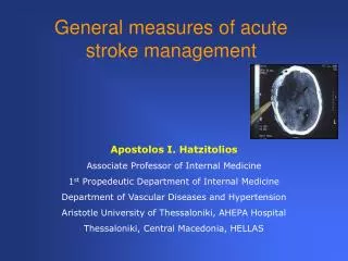 General measures of acute stroke management