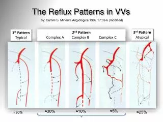 The Reflux Patterns in VVs