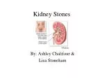 Kidney Stones - slide 1