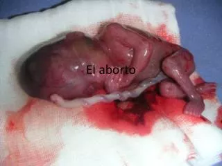 el aborto