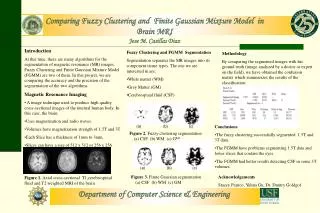 Comparing Fuzzy Clustering and Finite Gaussian Mixture Model in Brain MRI Jose M. Casillas Diaz