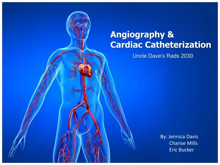 angiography cardiac catheterization