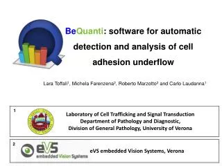 Be Quanti : software for automatic detection and analysis of cell adhesion underflow