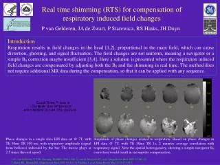 Real time shimming (RTS) for compensation of respiratory induced field changes