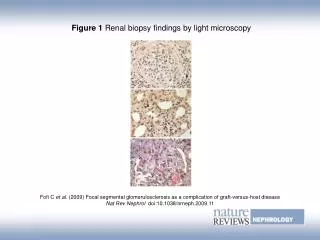 Figure 1 Renal biopsy findings by light microscopy