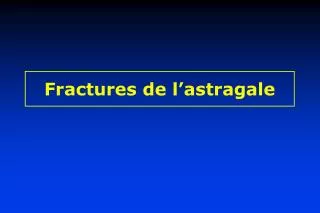 fractures de l astragale